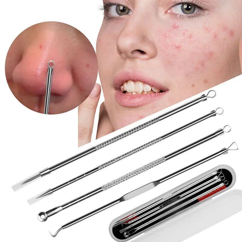 Luxury Skincare Acne - Blackhead Remover Tool Kit, Stainless Steel
