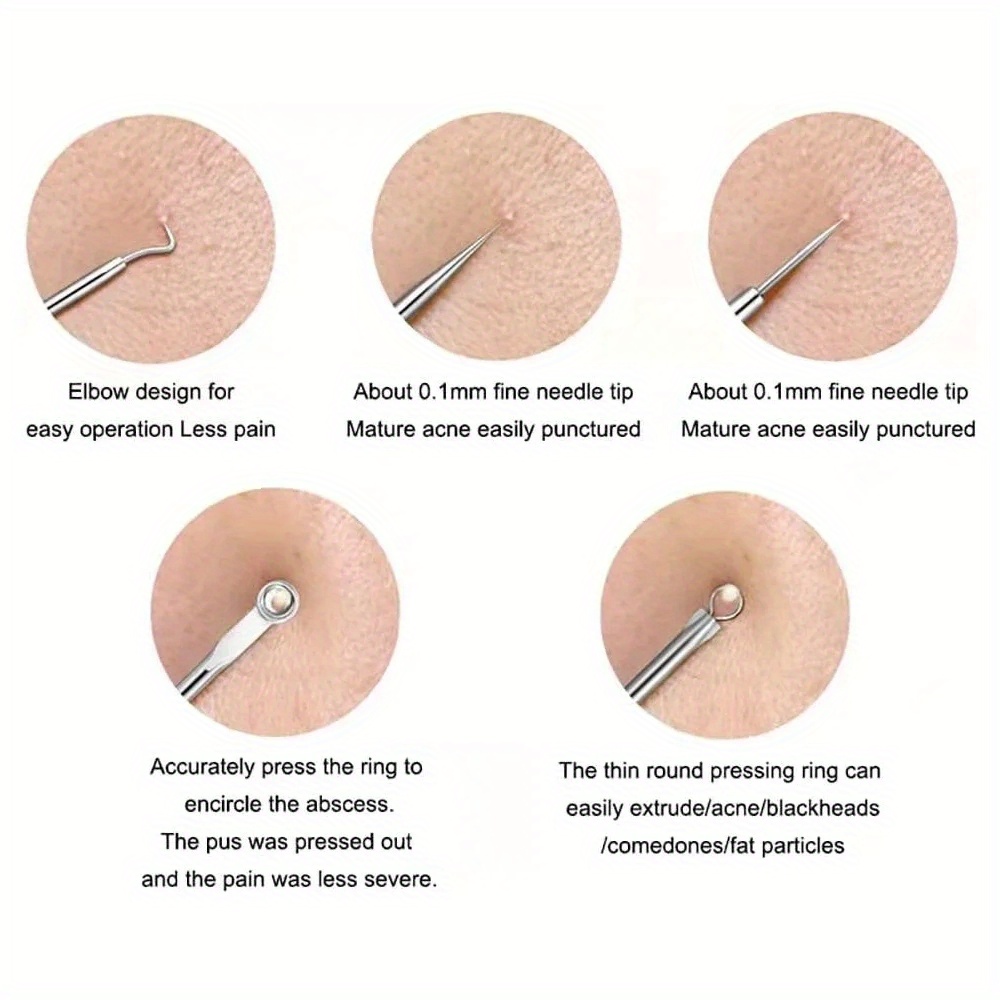 Pimple Popper Tool Kit Blackhe - Luxury Skincare Acne ulasan dan harga