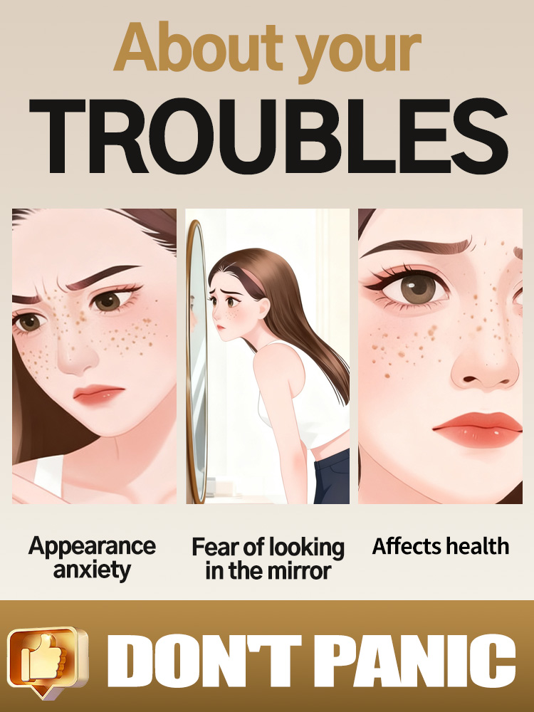 Lightening Facial Freckles Mel - Ultra Luxury Skincare ulasan dan harga