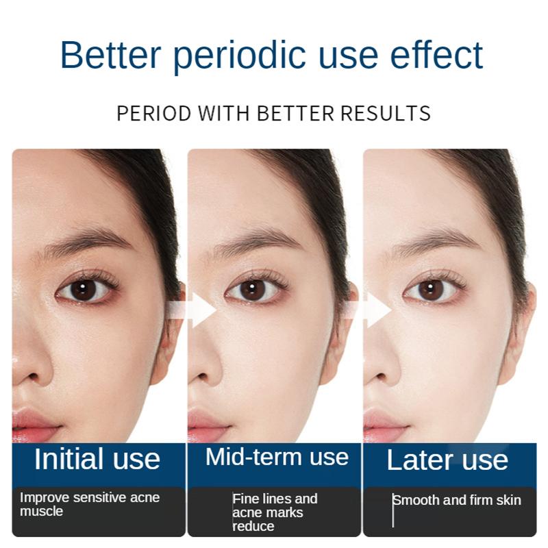 Facial Repair Lyophilized Powd - Oligopeptide Wrinkle ulasan dan harga