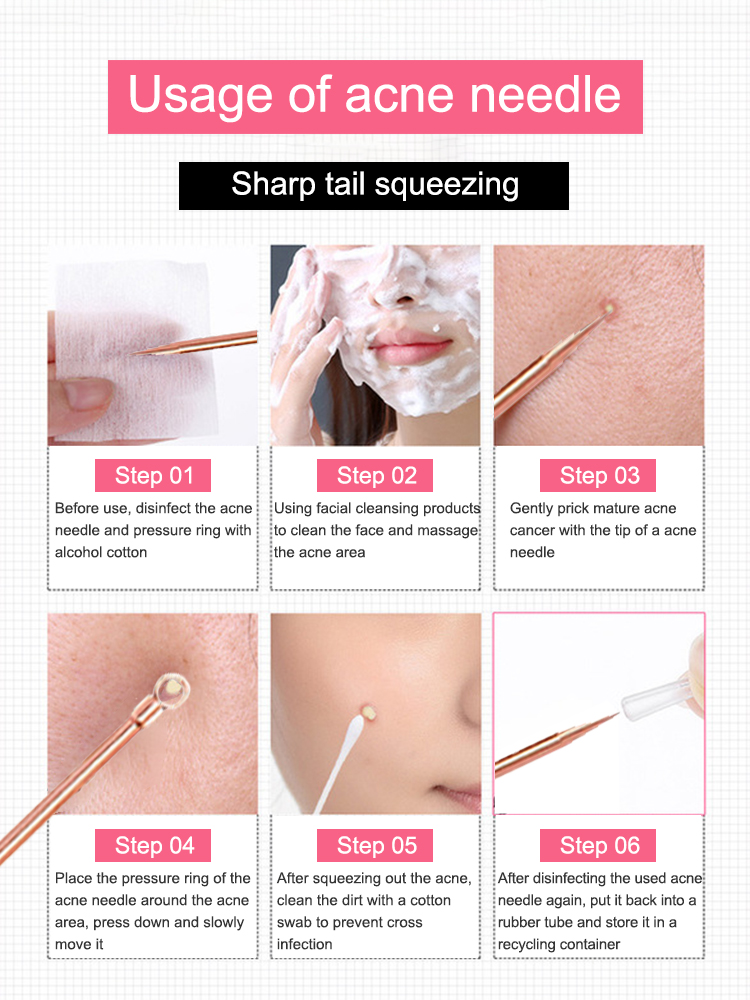 Blackhead Remover Pimple Comed - Luxury Skincare Acne ulasan dan harga