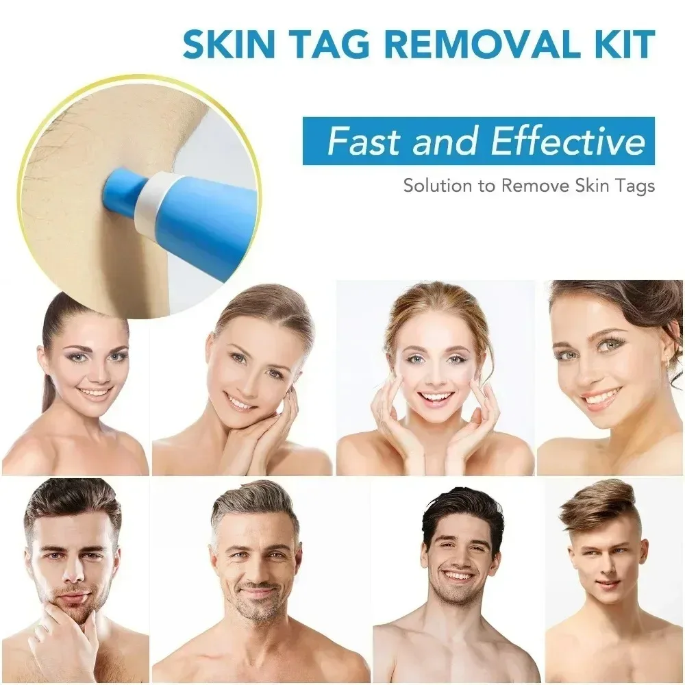 Acne Remover 2 IN 1 Auto Micro - Luxury Skincare Acne ulasan dan harga