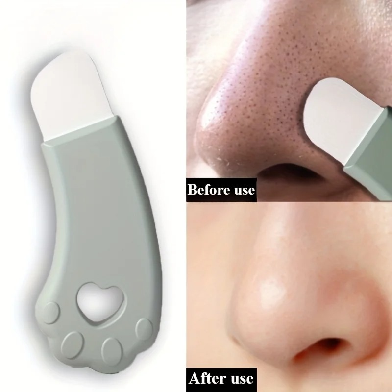 Cat Paw Blackhead Remover Tool - Luxury Skincare Acne ulasan dan harga