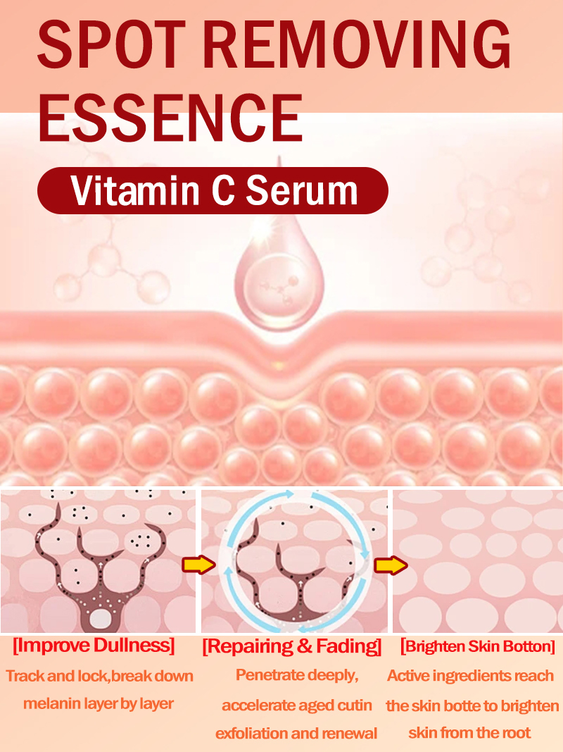 Lighten Freckles Melasma, Faci - Ultra Luxury Skincare ulasan dan harga