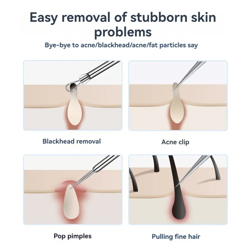 7pcs Stainless Steel Splinter  - Luxury Skincare Acne ulasan dan harga